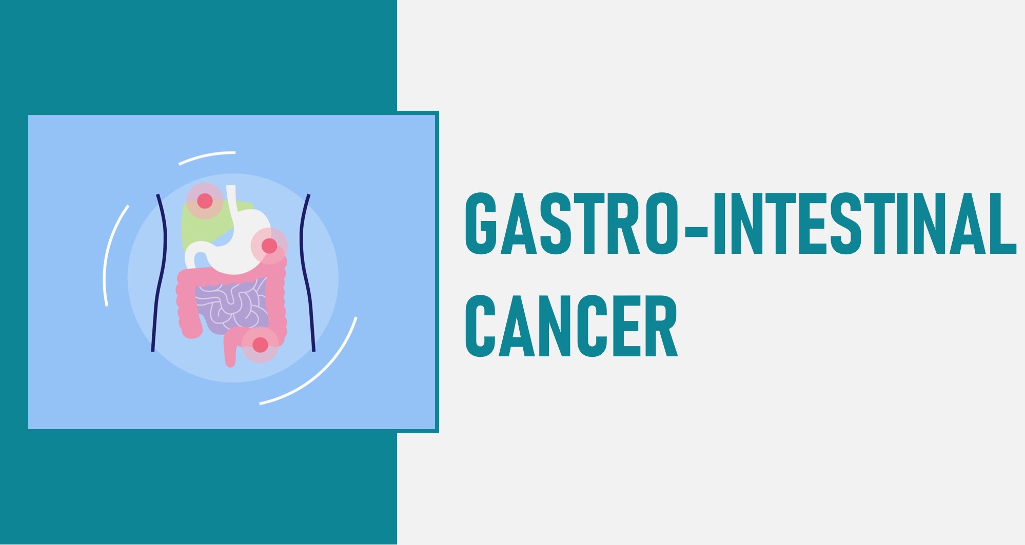 Everything You Should Know About Gastro-Intestinal Cancer
