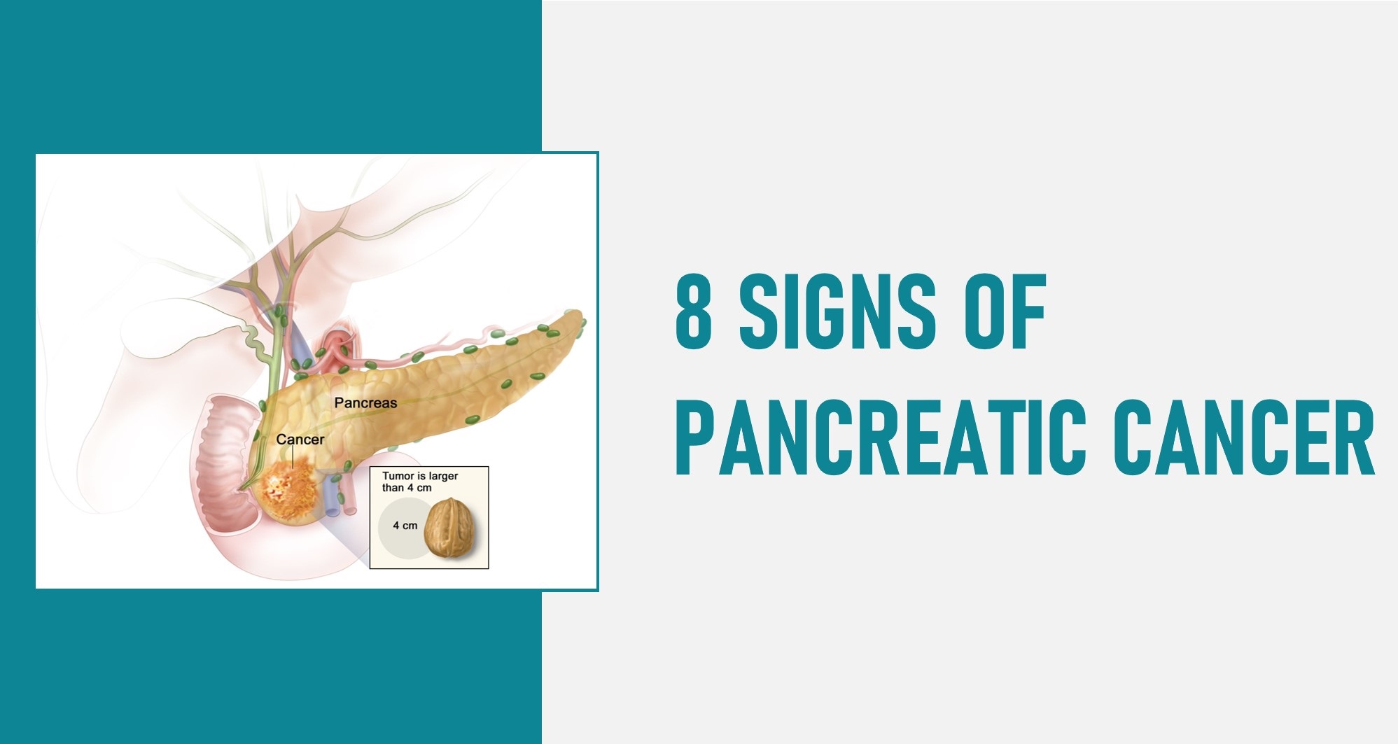 Do You Have Blood In Your Stool With Pancreatic Cancer