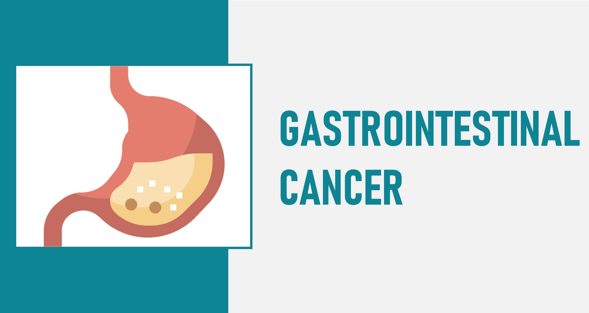 Gastrointestinal Cancers: How it starts & who gets it?